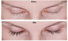 We will dive into how to apply latisse on eyebrows, successfully. Latisse 207 Laser Integrative Med