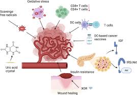 Image result for Hyperuricemia