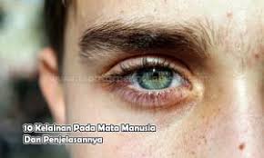 Check spelling or type a new query. Mata Merah