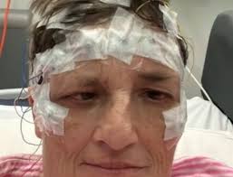 Michelle's Seizure Story