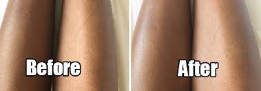 Then the hair grows back again. I Didn T Shave My Legs For A Month To See If This Painless Wax Was Actually Painless