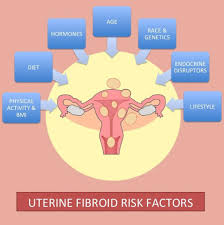 Epidemiology and Risk Factors of Uterine Fibroids - ScienceDirect