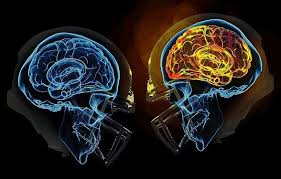 Looking for the definition of cte? Is Chronic Traumatic Encephalopathy Cte A Compensable Workers Compensation Claim Jernigan Law Firm