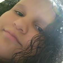 Ajude Samira Kelly em uma cirurgia de Ceratocone