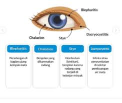 Check spelling or type a new query. Anatomi Mata Fungsi Kelainan Dan Keluhan