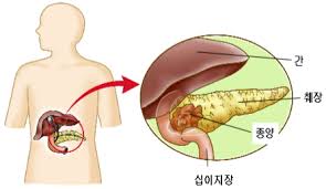 커피 등을 통한 카페인 섭취가 많은 사람들이 갑자기 카페인을 끊을 경우 나타난다. ì„œìš¸ì„±ëª¨ë³'ì› í‰ìƒê±´ê°•ì¦ì§„ì„¼í„°
