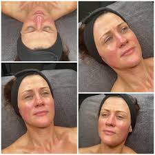 Fresh Face Loading… 💧 Our signature GLOW facial has really taken off this  year. Who needs make up when you've got this GLOW going on! We took this  skin from tight and