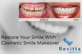 Are Your Teeth Crooked Discolored Or Chipped A Cosmetic Smilemakeover May Be The Answer For You Reconstructive Dentistry Dentistry Smile Makeover