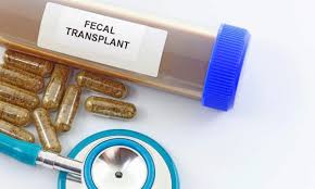 Image result for Fecal Transfer