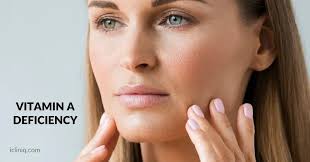 Image result for Vitamin Deficiency