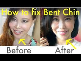 Spoon Exercise For Bent Chin Jawline How To Fix Asymmetrical Face Face Exercises Face Yoga Chin Exercises