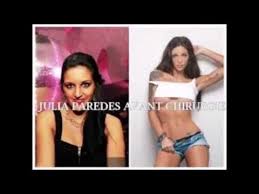 Et le moins que l'on puisse dire, c'est qu'elle ne ressemble plus à ce qu'elle était. Julia Paredes Avant Apres Chirurgie Photos Choc Youtube