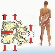 Image result for vyhřezlá ploténka