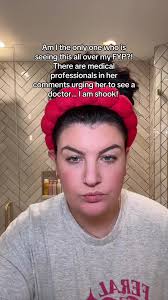 Stacy Tompkins Dermatologist