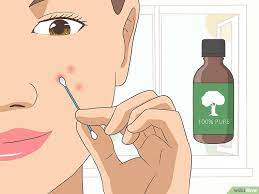 How To Use Tea Tree Oil For Acne Tea Tree Oil For Acne Tea Tree Oil Uses Tea Tree For Acne