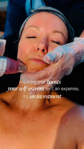 🌟 Tuesday Transfornation: Transform Your Life with Cinch Fast 30!🌟 Meet Elizabeth  McErlean, a retired community nurse, who, is looks and feels fabulous! ❤️  Liz, along with her husband, have lost over