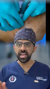 Genicular Artery Embolization (GAE) for Knee Pain Complete Procedure Shown  Live- Part 1, Follow @drraghavseth for more👆, Connect with Dr. Raghav Seth  (Interventional Radiologist) for more details, 📞 ...