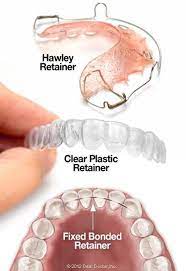 Post Orthodontic Care Hatcher Orthodontics Chesapeake Va Dental Retainer Orthodontics Dental