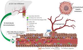 It usually begins as small, noncancerous (benign) clumps of cells called polyps that form on the inside of the colon. Frontiers Colorectal Cancer Stem Cells In The Progression To Liver Metastasis Oncology