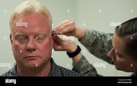 Air force acupuncture hi-res stock photography and images