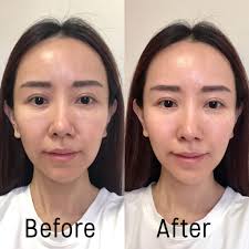 Aqua , alcohol denat , butylene glycol , glicerina , octocrileno , palmitato de isopropilo , cetearyl. Eucerin Hyaluron Filler Overnight Treatment Review