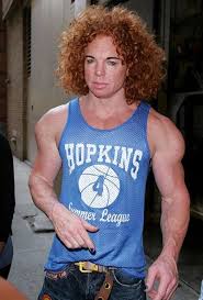 What Happened To Carrot Top And Why Does He Look Like Walking Photoshop Carrot Top Plastic Surgery Carrot Top Bad Plastic Surgeries