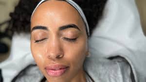Best dermaplaning skin treatments near me in Forest Fields, Nottingham