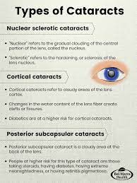 Cataract Types Nuclear Sclerotic Cortical And Posterior Subcapsular Eye Facts Eye Health Eyes