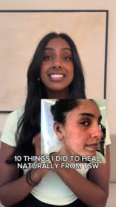 Procedure for Withdrawal from Pepeta Aviator