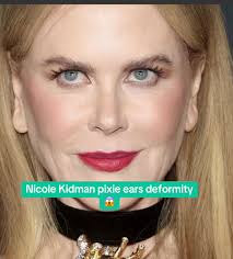 Nicole Kidman Ears
