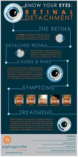 Know Your Eyes Infographic Retinal Detachment Provided By Alphapointe Www Alphapointe Org Vitreousfloaterstreatment Makeupeyeinfographic Eye Facts Eyes Healthy Eyes