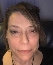 Here my before and after! Facing the window, no filter! Love the full  coverage 🙌❤️