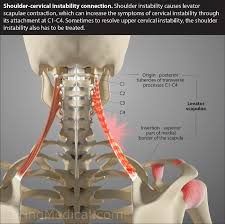 This lesson on the shoulder girdle, will complete the bones of the torso. Is Neck Instability Causing Your Shoulder Pain Caring Medical Florida