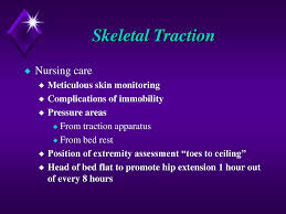 ?itemid=201 * intext:gaming + pro &.asp. Bucks Traction Position Proximal Femur Fracture Management With Minimal Resources