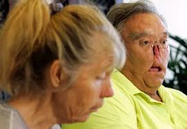 Man's grisly injuries after crazed chimps tore off face and privates at  birthday picnic