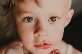 Potresne fotografije svjedoče o borbi male curice s rakom: Moja kći se  borila kao šampion