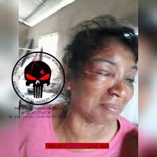 This is my sister Sharmin Jaggernauth.She is suffering from domestic  violence all her life. Somebody please help her.Its gone to far. Her  husband also known as "red back" of Quinam Road, Penal.This