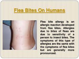 Time to be aware of fleas' bites and learn everything about them: Flea Bites