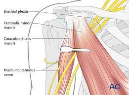Learn their origins/insertions, functions & exercises. Deltopectoral Approach