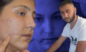 Aysel Perkgün davasında ilginç anlar! Duruşma salonu boşaltıldı... Yara  izleri incelendi