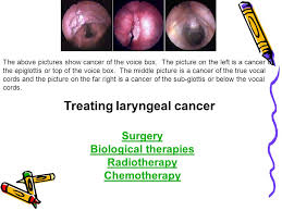 The larynx is the upper end of the lower airway. A Compilation On Galarbud Laryngeal Cancer Ppt Download