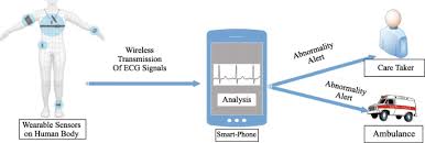 The intelligent mobile phone detection project is an advanced device which finds various applications in the modern fields of communication and as shown in figure 1 the system is designed to work as a mobile phone detector. Survey Smartphone Based Assessment Of Cardiovascular Diseases Using Ecg And Ppg Analysis Bmc Medical Informatics And Decision Making Full Text