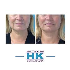 Jeffrey Klein MD, HK Dermatology