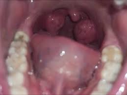 356 550 показов 84% puba. Tonsils Porn Videos Fuqqt Com