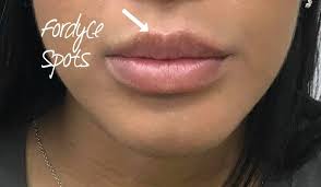 Nuestra Hermosa Paciente Queria Montalvan Dermatology Facebook