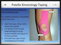 Kinesiology Tape Knee