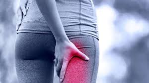 Schmerzen an der innenseite des oberschenkels zur leiste hin, oft auch am sitzknochen; Starke Schmerzen In Gesass Beinen Und Rucken Das Piriformis Syndrom