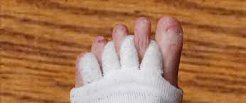 Stretch Socks To Treat Morton S Neuroma The Center For Morton S Neuroma