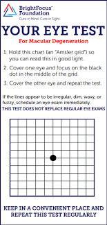 The Amsler Grid Can Help Detect Early Signs Of Retinal
