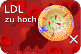 Ldl Cholesterin Erhoht Zu Hoch Blutwert Ldl